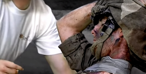 Minh họa tình huống thực tế. băng ép từ vùng cổ qua nách đối diện với bất kỳ vật dụng gì.